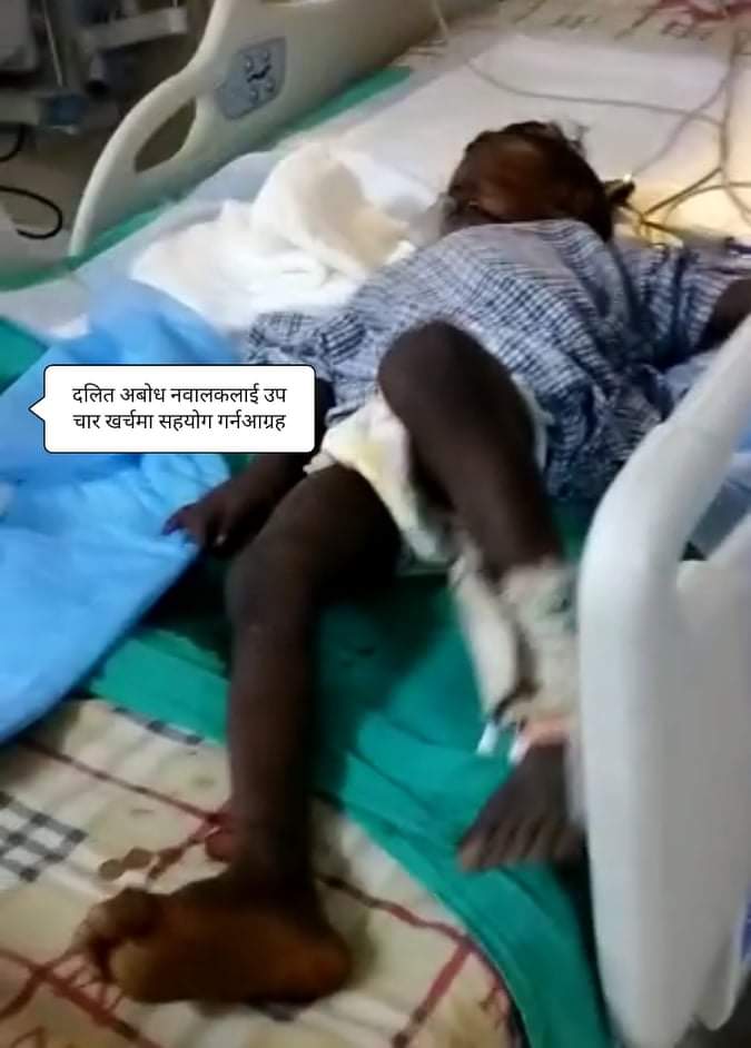 अबोध दलित बच्चालाई ठक्कर दिएर फरार उपचार खर्च जुटाउनु सहयोगको अपेक्षा 